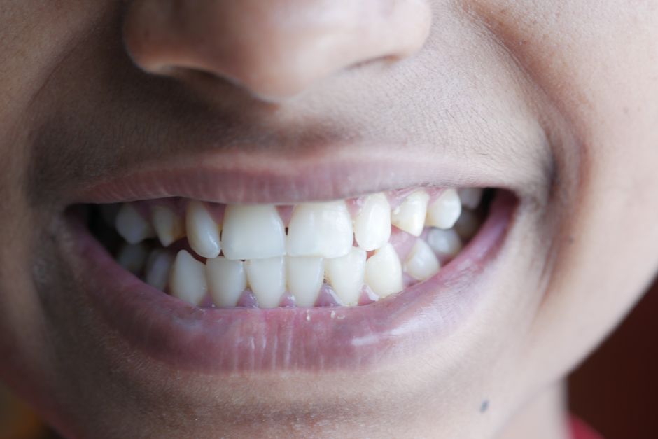How to Build a Natural Oral Care Routine for Fresh Breath and Healthy Gums