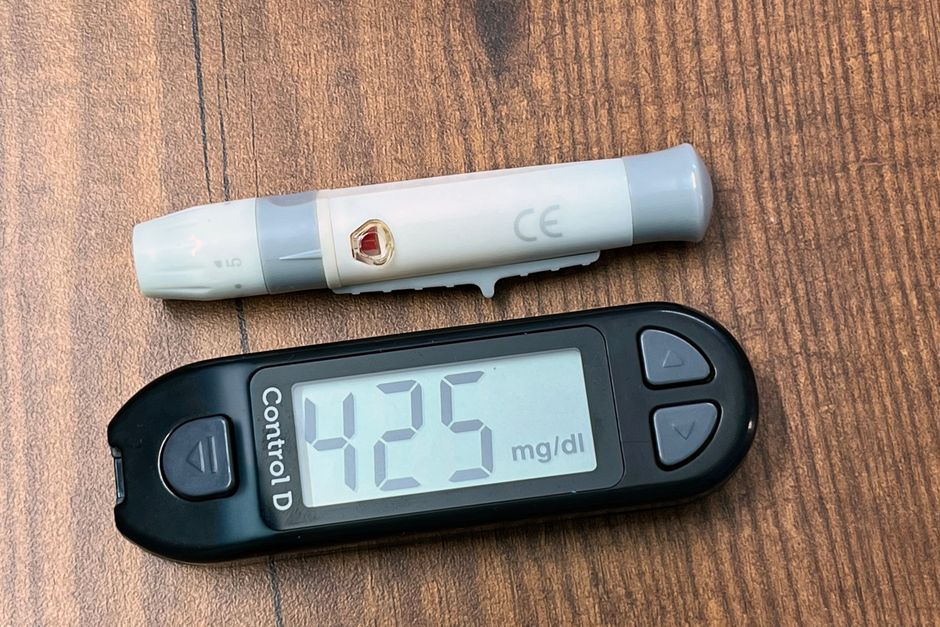Stud Finders and Moisture Meters: Why One Reading Is Never a Diagnosis