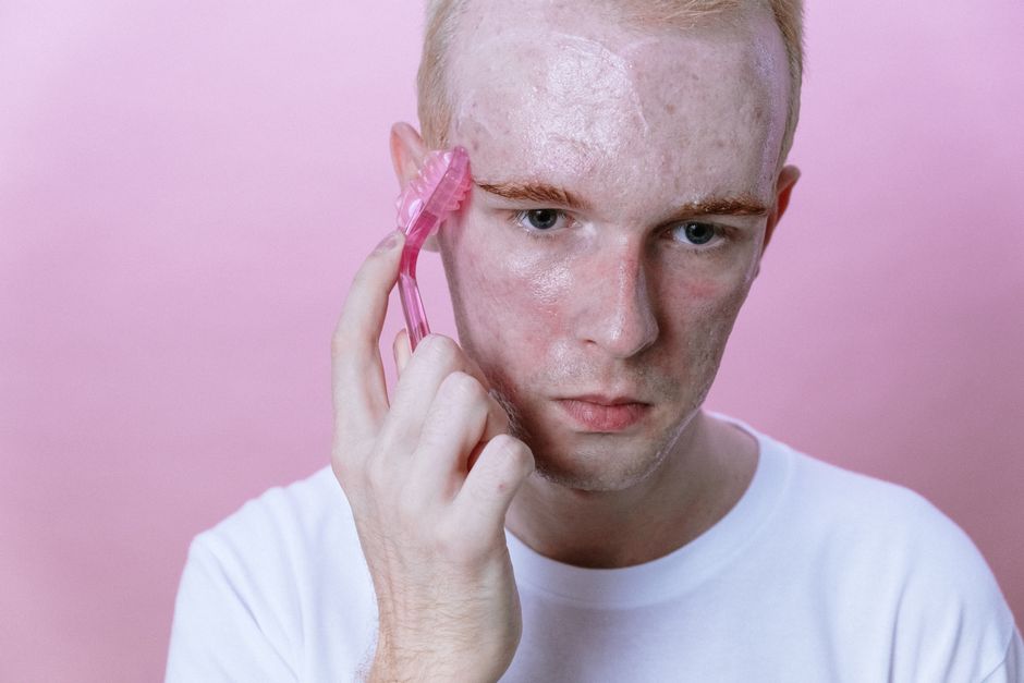 Why Your Acne Routine Isn't Working: A Science-Backed Guide to Clearer Skin