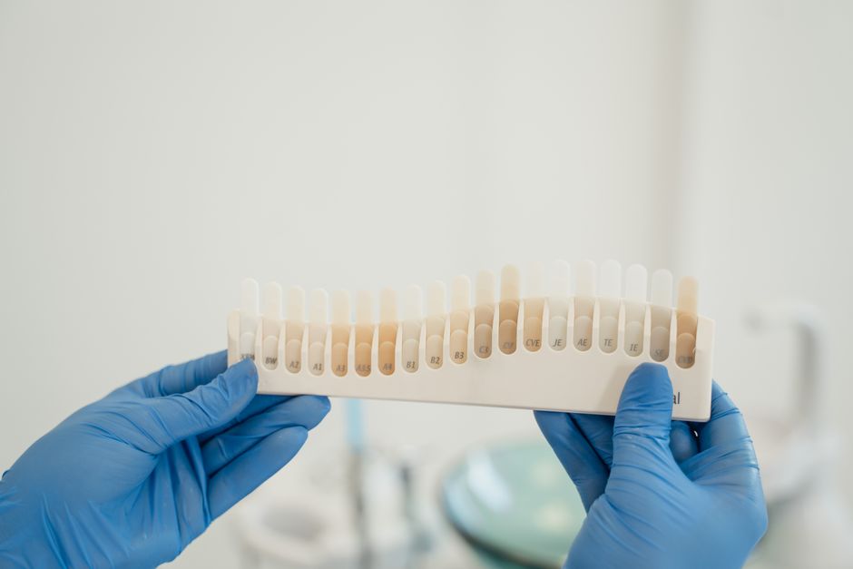 7 Teeth Whitening Mistakes That Are Ruining Your Smile (And How to Fix Them)
