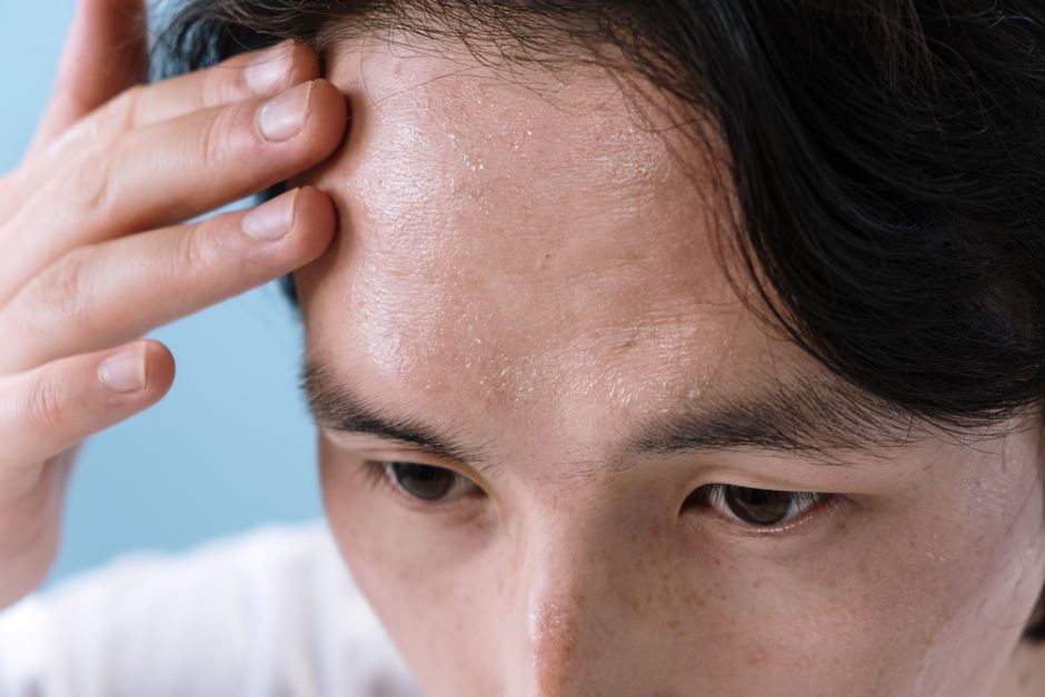 When Stinging, Tingling, or Peeling Feels Like Progress: How to Read Sweat-Triggered Skin Reactions