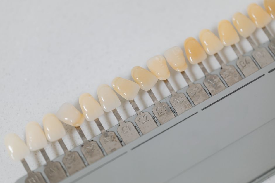 How to Whiten Your Teeth Naturally and Safely: A Step-by-Step Guide