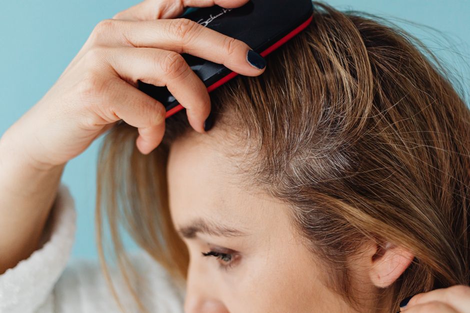 Winter Scalp Care: How to Stop Flaking, Itching, and Tightness