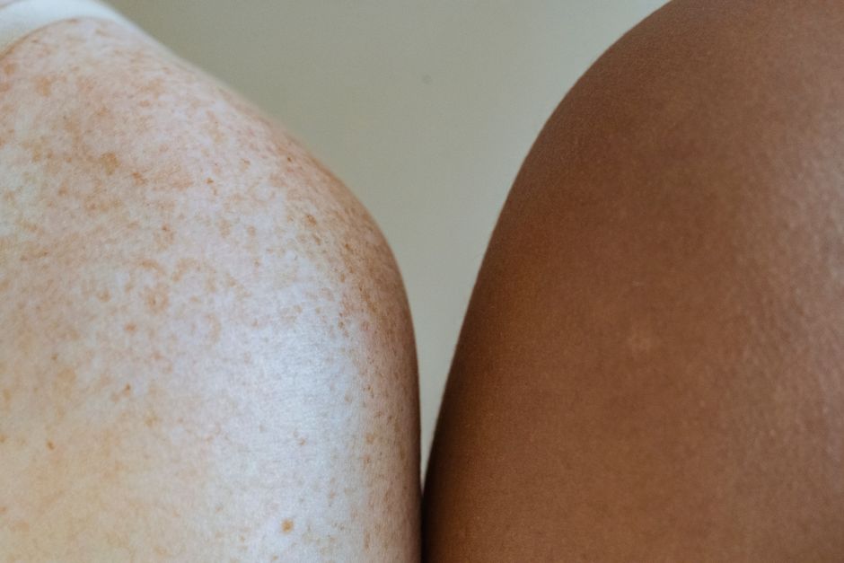 Body Skin Changes That Fade vs. Changes That Persist: How to Tell the Difference