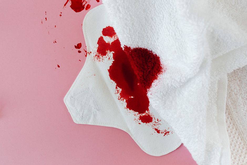Dye Transfer Stains on Fabric: Why They Happen and How to Lift Them Safely