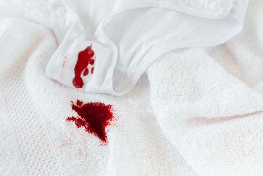 How to Remove Laundry Stains When You Rent: A Landlord-Friendly Stain-Removal Guide