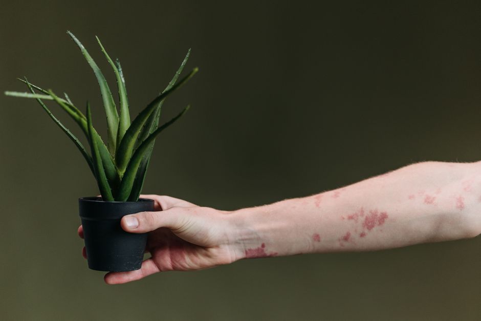 Itch Without a Rash: How Eczema-Prone Skin Signals Trouble Before Anything Shows